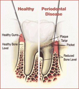 health tooth diagram