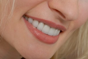 Gum Disease Healthy Dentistry Indianapolis